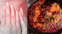 Makan_Hot_Pot_Berujung_Maut_Wanita_Tewas_Akibat_Sakit_Tenggorokan