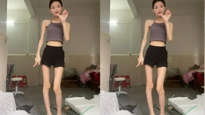 Bahaya SkinnyTok: Tren Diet TikTok Picu Gangguan Makan?
