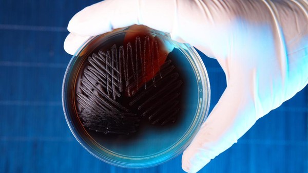 Indonesia Darurat Antibiotik: Bakteri Superbug Menyerang, 45% Obat Tak Mampu!