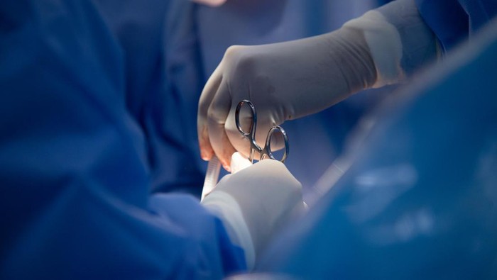 Kontroversi Caesar: Dokter Umum Boleh Operasi? POGI Tolak Keras!