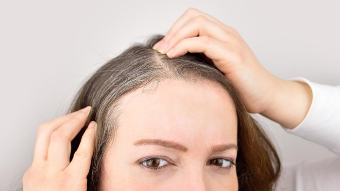 Rambut Beruban di Usia Muda? Ini Penyebab & Solusinya
