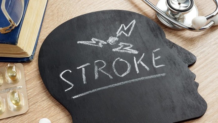 Wanita Muda 23 Tahun Alami Stroke: Kisah Inspiratifnya