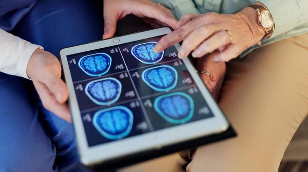 Waspada! Gejala Stroke: Kenali Penyumbatan Pembuluh Darah Otak