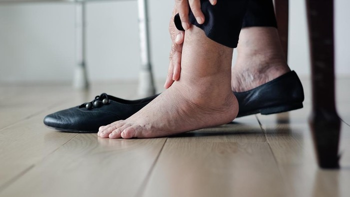 Waspada! Masalah Jantung Tersembunyi di Kaki, Usia Muda