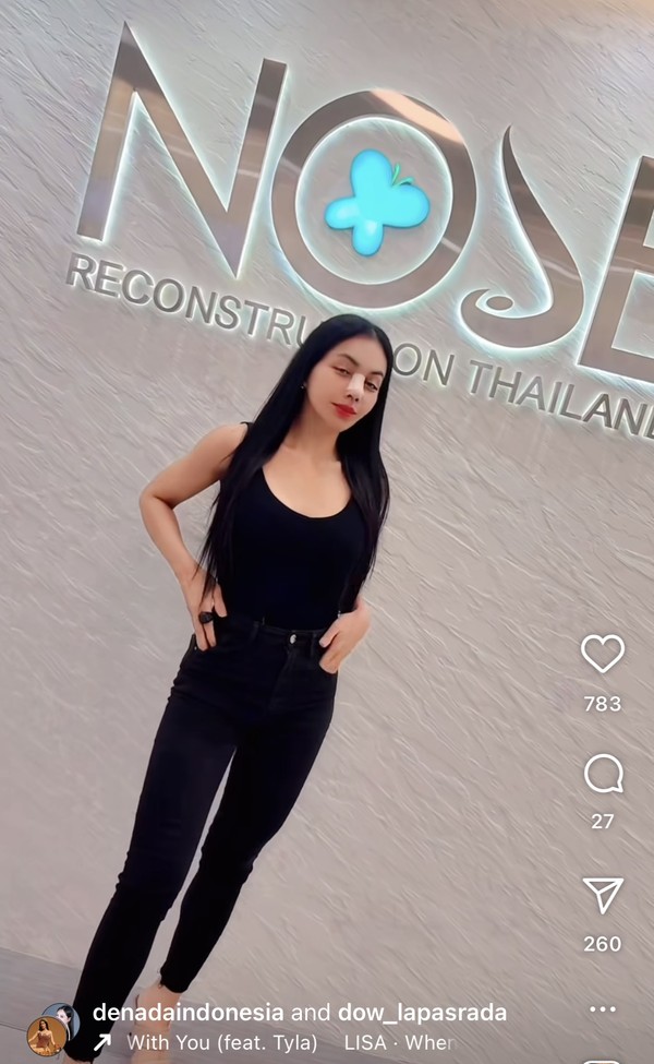 Resep Rahasia Diet Denada: Donat Hingga Nasi Padang